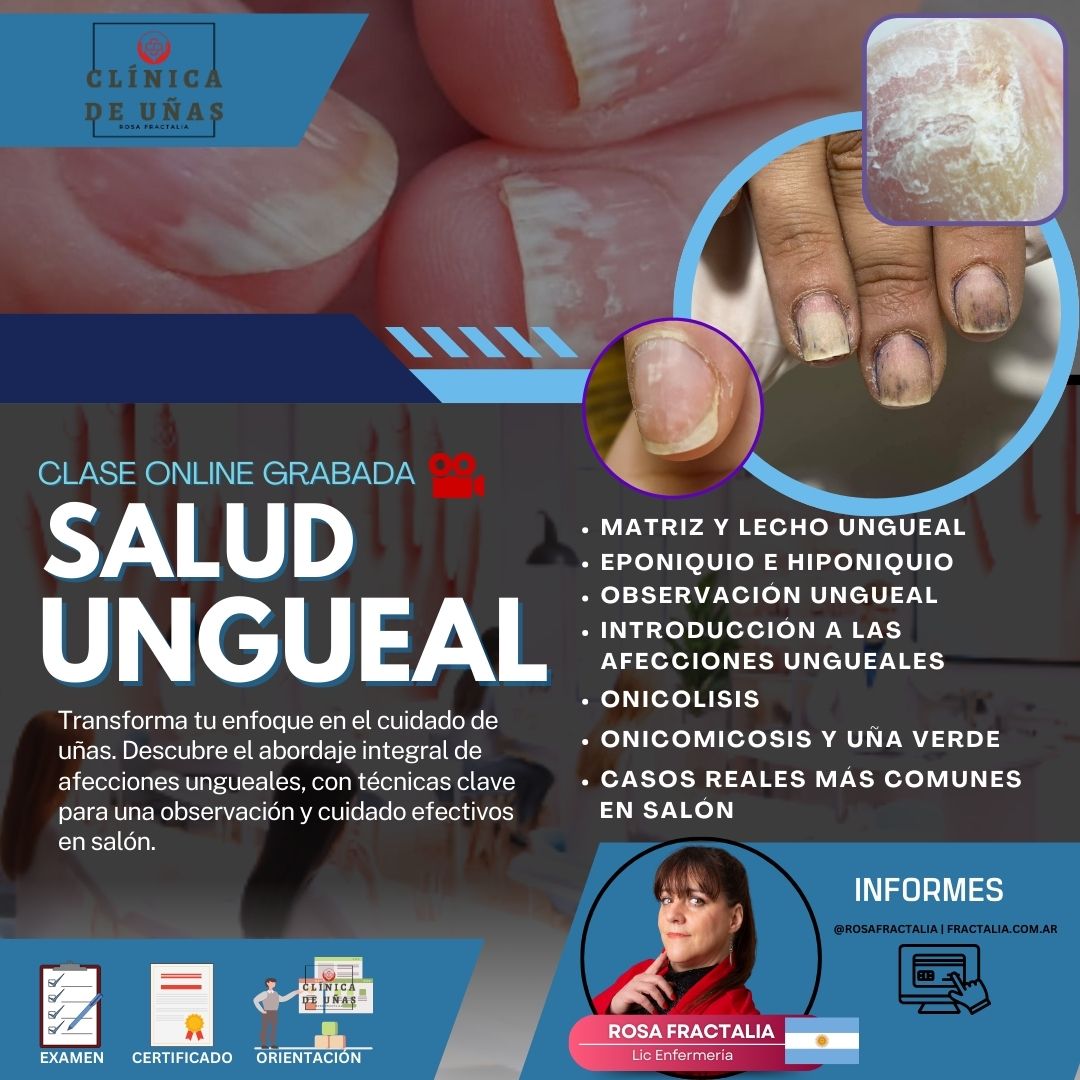 salud ungueal