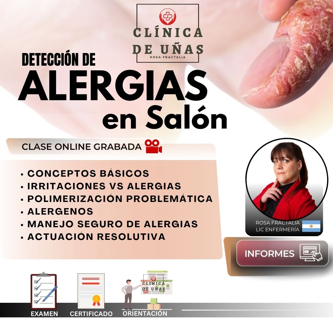 alergias