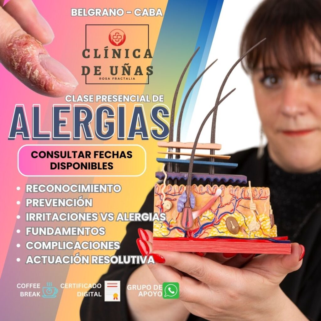 alergias